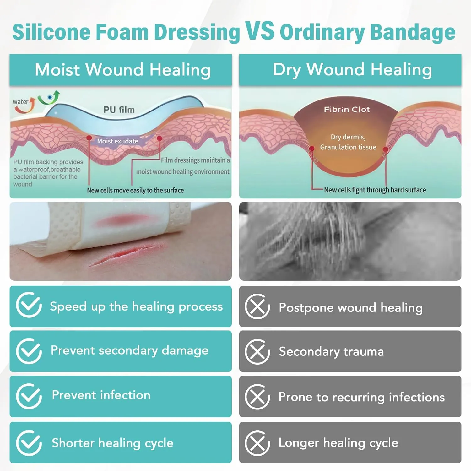 Silicone Foam Dressing with Adhesive Border 4“ x 4”,20 Packs Waterproof Silicone Bandages for Wounds Care, Large Self Adhesive Wound Dressing Bandage for Bed Sore, Foam Pad, FSA HSA Eligible